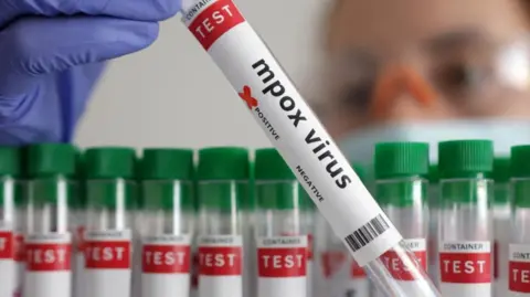 Reuters  A test tube labelled "Mpox virus positive" is held in this illustration taken August 20, 2024.