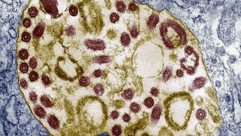 Getty Images Electron Micrograph Of The Marburg Virus