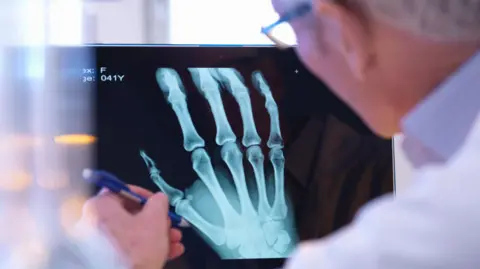 Getty Images Doctor looking at an X-ray of someone's hand