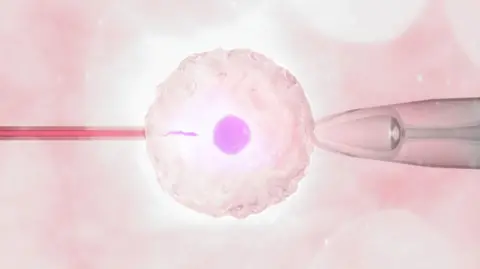 Getty Images Illustration of in vitro fertilisation (IVF) where the sperm is inserted into the egg in a test tube, to create an embryo which is then implanted into a woman to create a pregnancy