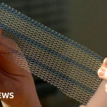 Mesh victims still wait for financial compensation