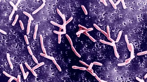 Getty Images Campylobacter Is A Family Of Curved Gram Negative Bacteria.