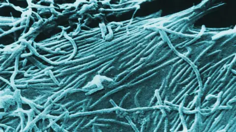 Getty Images An image of the microscope picture of Ebola